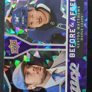 2021/2022 Upper Deck MVP Before & After BA-01 Auston Matthews Inzert